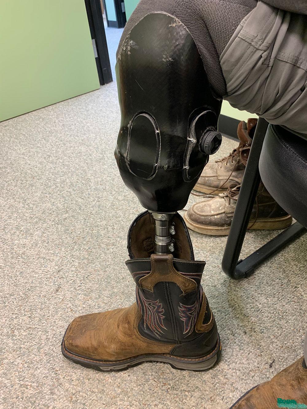 Adjusting the prosthesis for boots